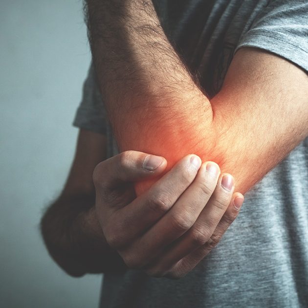Man holding his elbow that is glowing red with pain